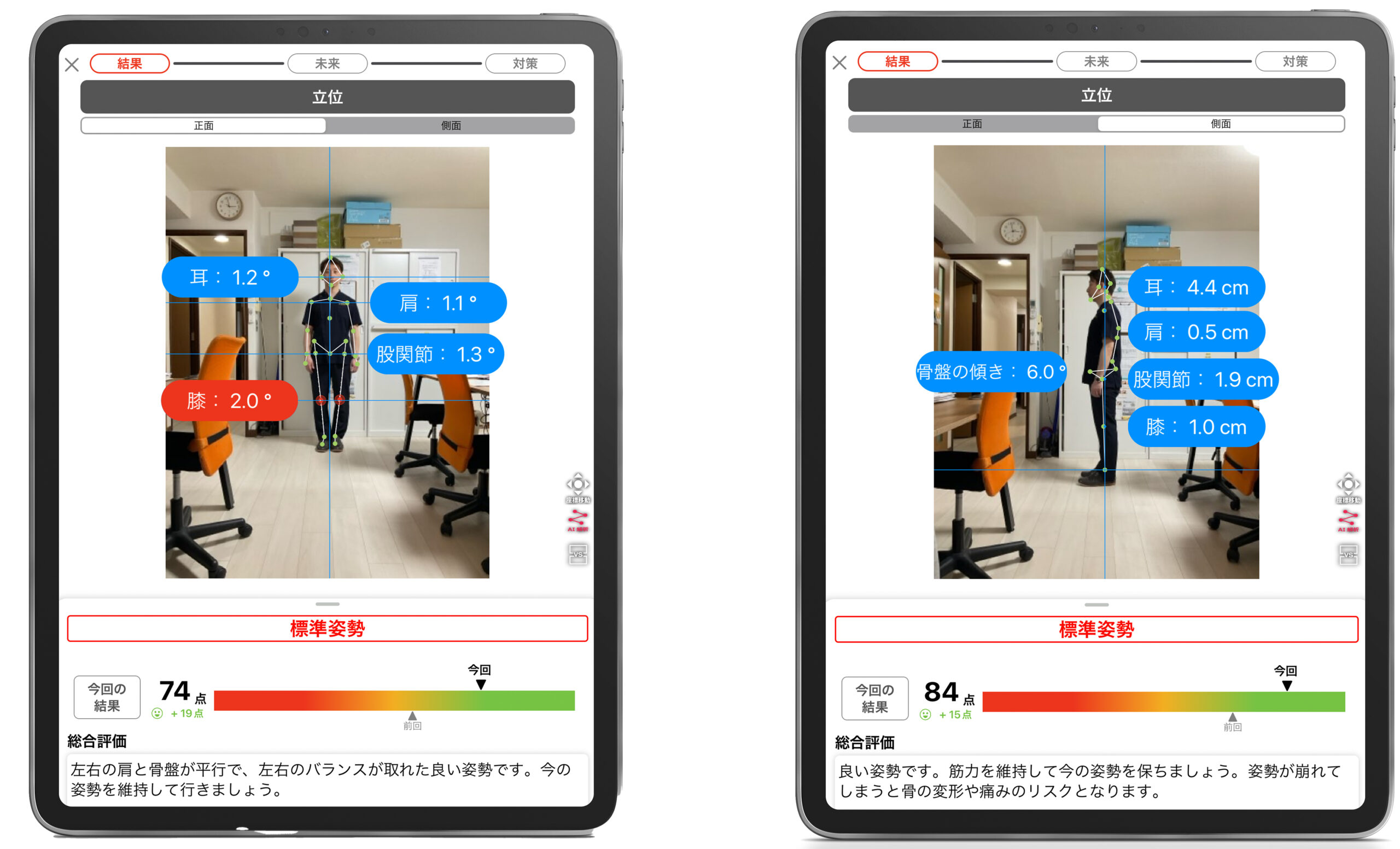 iPadを活用したリハビリ分析画面